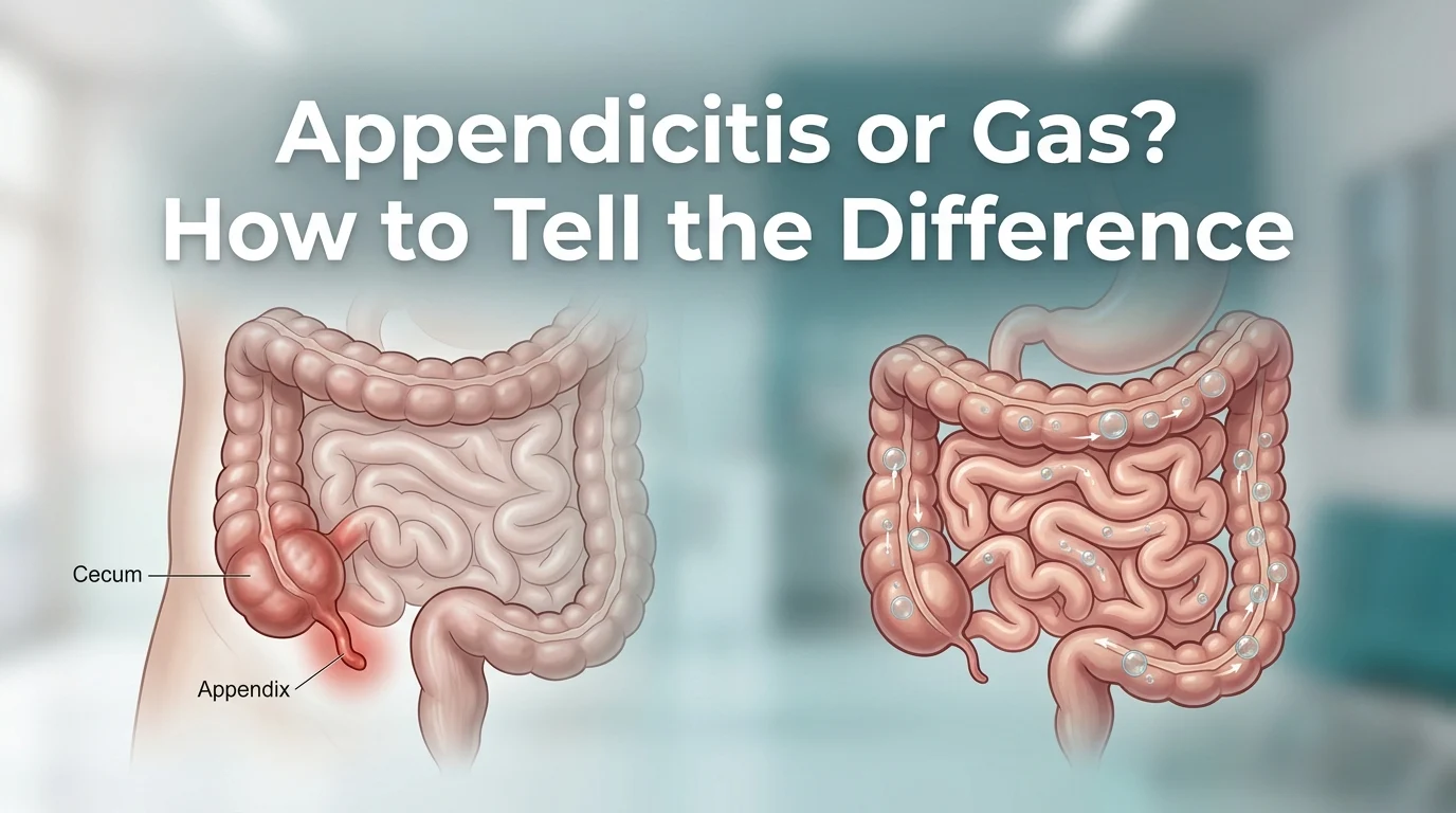 Appendicitis or Gas
